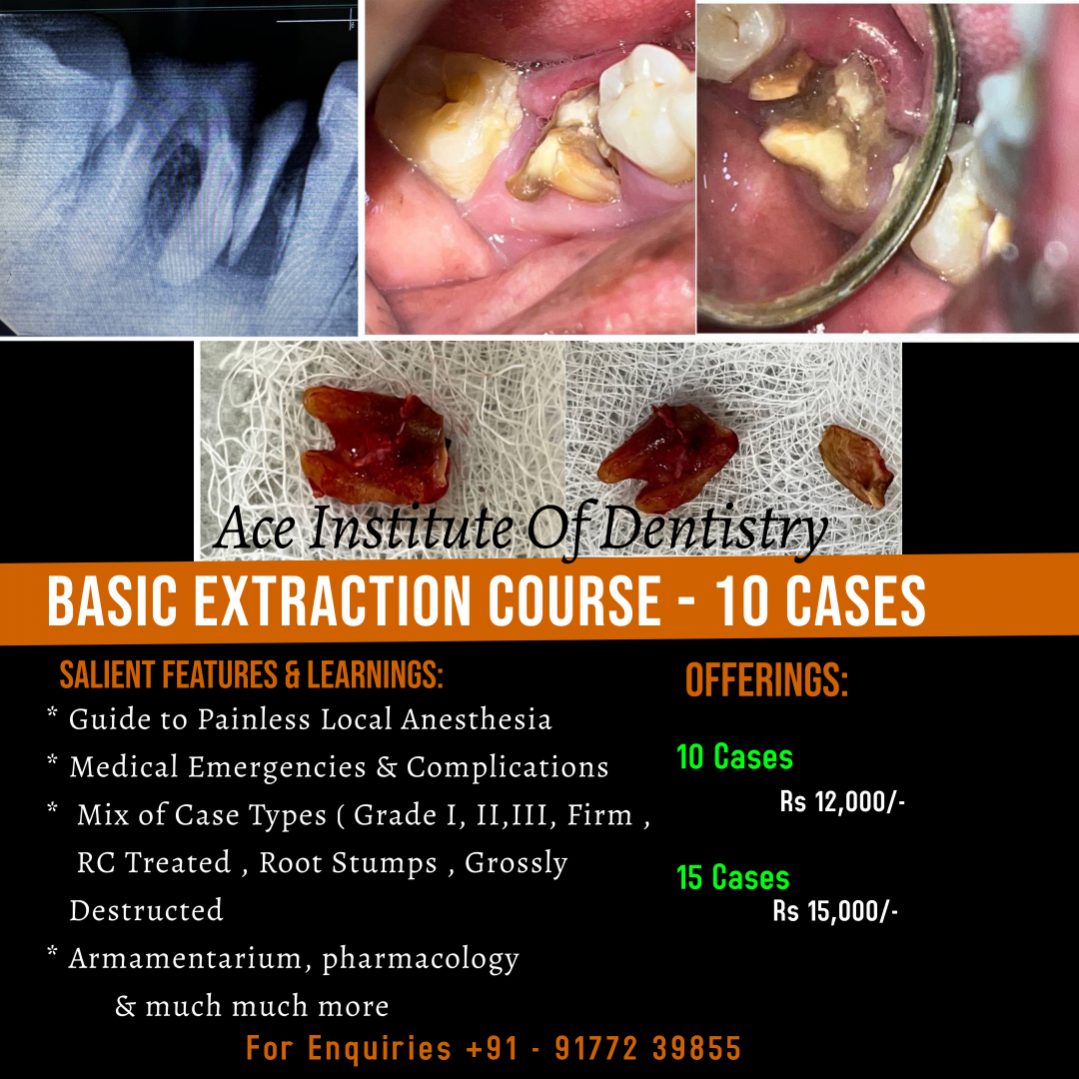 Basic Extraction Course 10 Cases Ace Dental