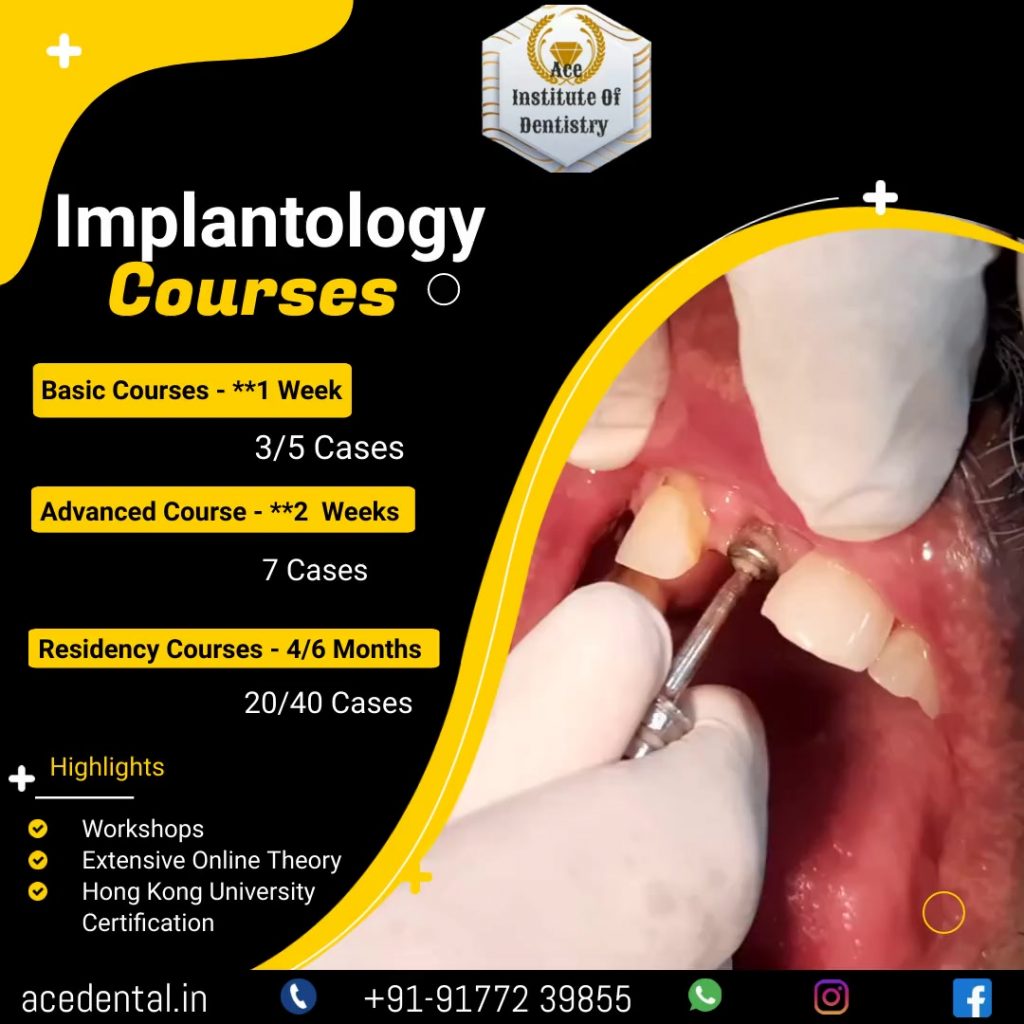 Implantology Courses in India