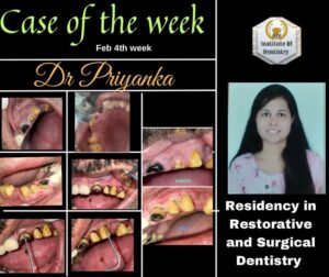 Dental Case of the Week, Ace Institute of Dentistry